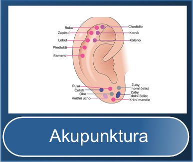 Akupunktura