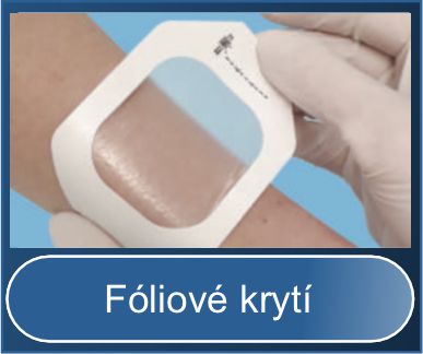 Fóliové krytí