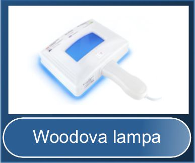 Woodova lampa