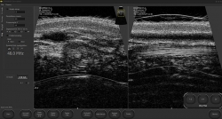 DRAMINSKI DERMAMED ultrazvuk pro dermatologii a estetickou medicínu