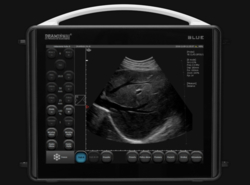 Sonograf DRAMINSKI - BLUE - mobilní ultrazvuk pro lékaře vyžadující mobilní zařízení s velmi kvalitním zobrazením