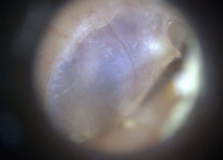 Digitální otoskop EarScope Basic Dinolite