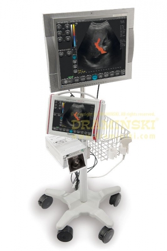 DRAMINSKI OPUS D mobilní ultrazvuk pro lékaře vyžadující mobilní zařízení s velmi kvalitním zobrazením